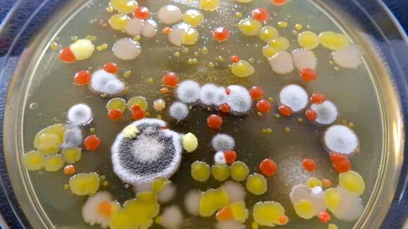 A variety of different bacteria and fungi isolated as part of LSTM's Swab and Send project 