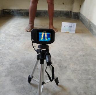 Camera set up for taking images of participants lower legs