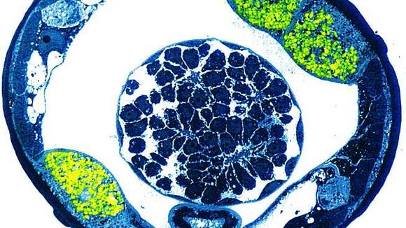 Cross section filarial nematode wolbachia in green