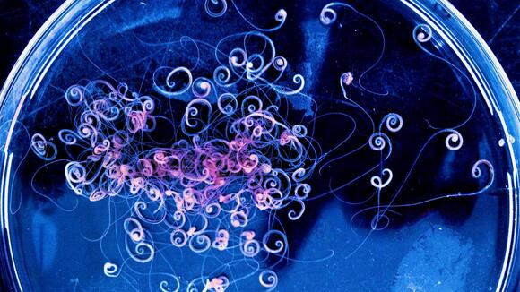 Image of Ecuadorian whipworms (image: Mark Taylor)