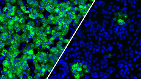 Human cells normally infected with SARS-CoV-2, here shown in green (left). Upon treatment with a sub-inhibitory dose of a glycosylation inhibitor, the infection is greatly reduced (right)