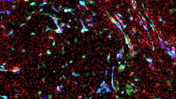 Infected lung epithelial cells