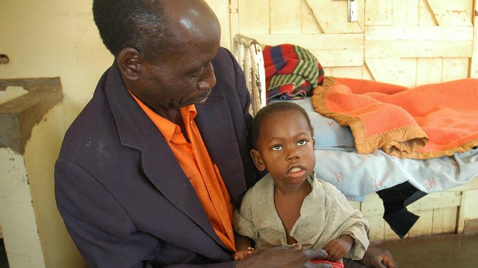 Credit: Jmesser5 via Wikimedia Commons. Child recovering from cerebral malaria