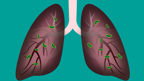 Animation of a pair of lungs