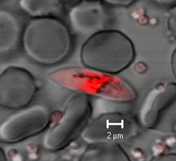 Plasmodium falciparum late-stage gametocyte, one of the parasite stages targeted by primaquine