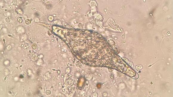 The egg of a hybrid schistosome, the subject of the new research