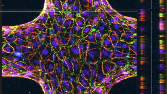 A 3D model of a bovine blood vessel