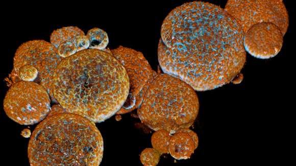 SnakeOrganoids: Credit Ravian Van Ineveld Copyright- Princess Maxima Center For Pediatric Oncology