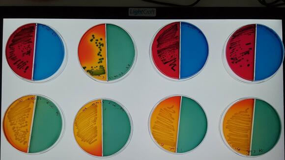 E.coli samples