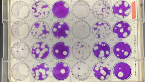 Plaque assays which are done to quantify virus infectivity