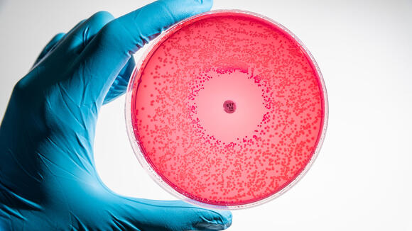 microbiological culture being examined