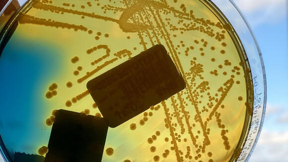 E.coli grown on an agar plate held against the sky