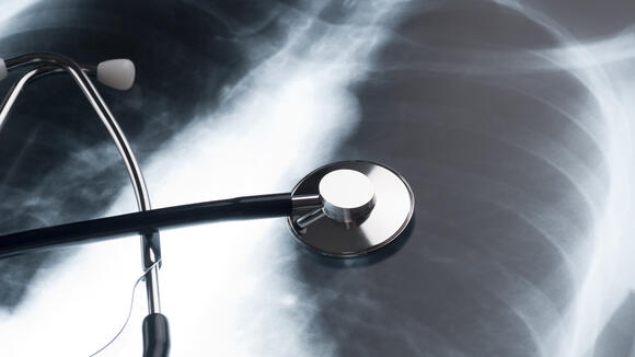 Image of a chest x ray