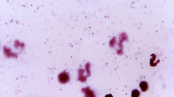 plasmodium falciparum 